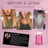 HairBunny Hajvitamin előtte-utána